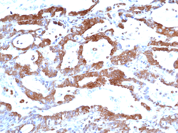Anti-FAK (Focal adhesion kinase 1) Rabbit Monoclonal Antibody, Clone RM472