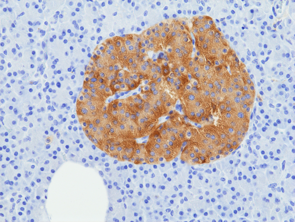 Anti-SV2A Rabbit Monoclonal Antibody, Clone RM520