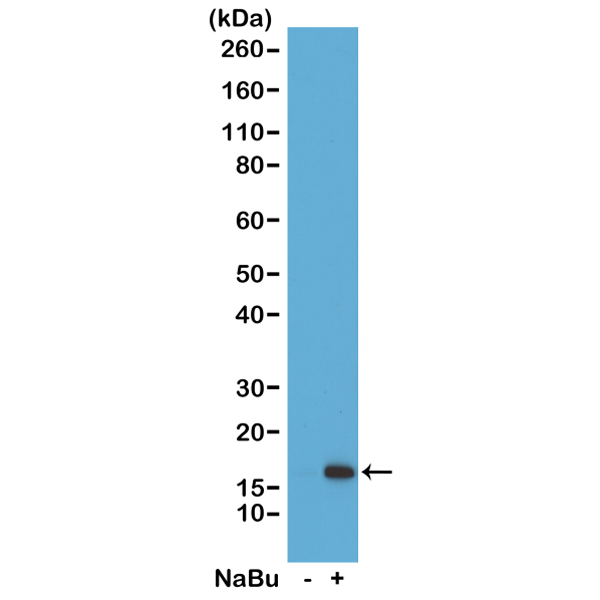 Anti-Acetyl-Histone H3 (Lys36) Rabbit Monoclonal Antibody, Clone RM154