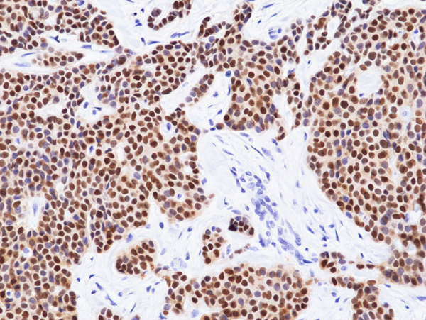 Anti-GATA3 Rabbit Monoclonal Antibody, Clone RM482