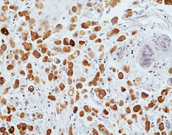 Anti-MGB1 Rabbit Monoclonal Antibody, Clone RM519