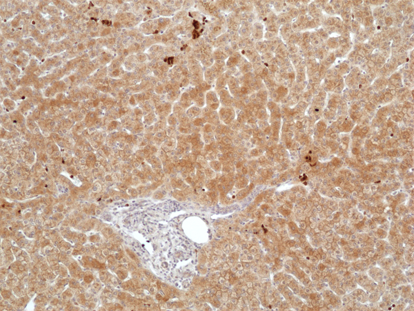 Anti-FGL1 Rabbit Monoclonal Antibody, Clone RM502