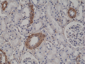 Immunohistochemical