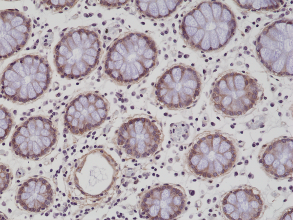 Anti-CD29 Rabbit Monoclonal Antibody Rabbit Monoclonal Antibody, Clone RM285
