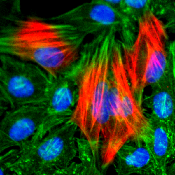 Anti-Calponin-1 Rabbit Monoclonal Antibody, Clone RM262