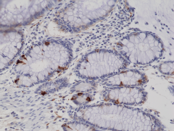 Anti-Synaptophysin Rabbit Monoclonal Antibody, Clone RM258