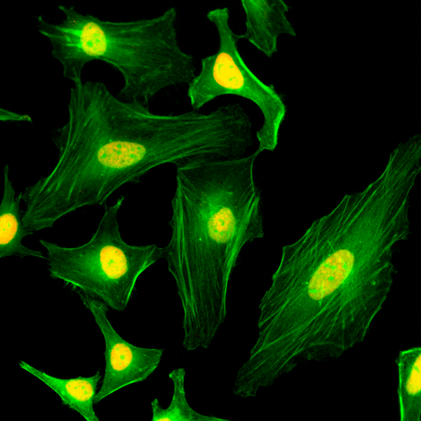 Anti-Macro H2A.1 Rabbit Monoclonal Antibody, Clone RM248