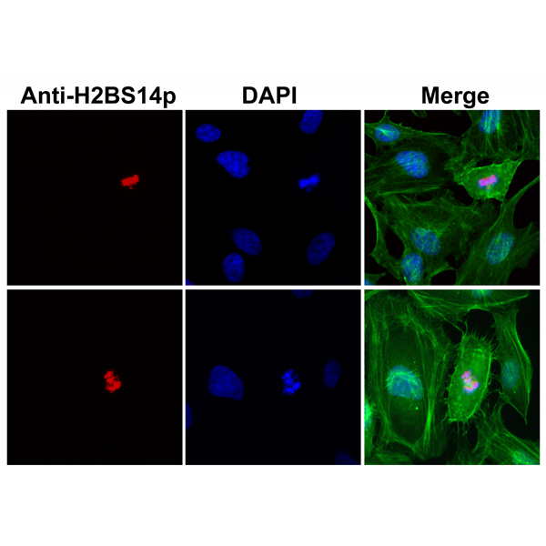 Anti-Phospho-Histone H2B (Ser14)Rabbit Monoclonal Antibody, Clone RM238