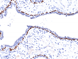 Immunohistochemical
