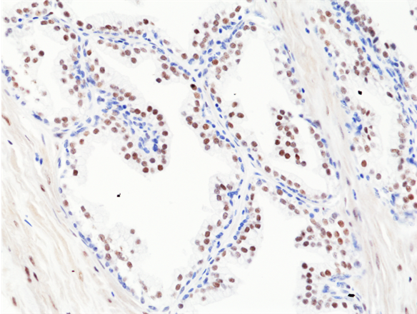 Anti-Androgen Receptor (C-term) Rabbit Monoclonal Antibody, Clone RM255