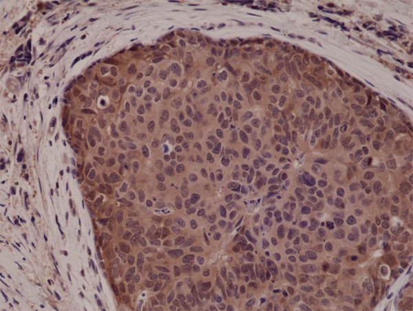 Anti-p38 MAPK Rabbit Monoclonal Antibody, Clone RM245