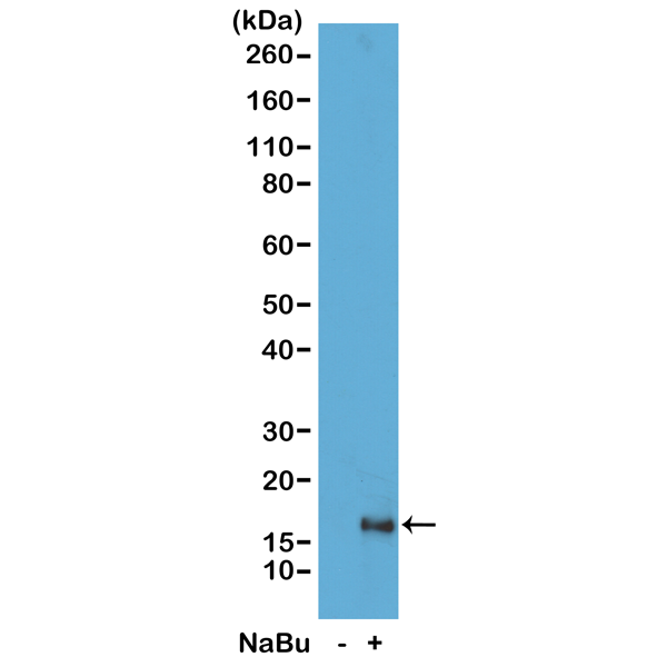 Anti-Acetyl-Histone H3 (Lys79) Rabbit Monoclonal Antibody, RM156