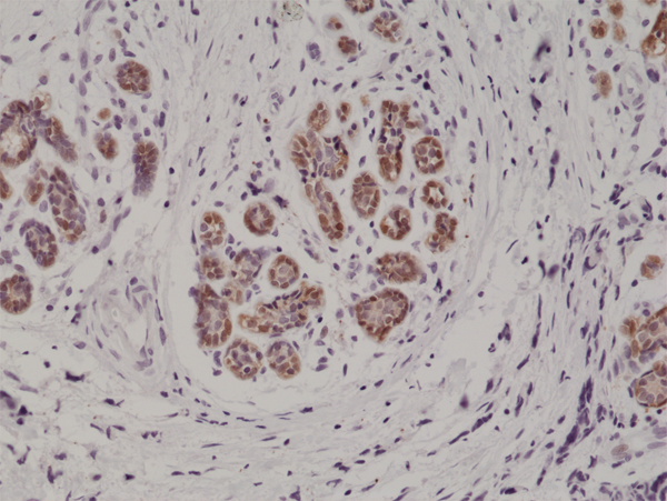 Anti-S100B Rabbit Monoclonal Antibody Rabbit Monoclonal Antibody, Clone RM304