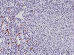 Immunohistochemical