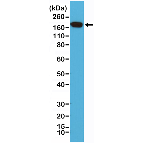 Anti-EGF Receptor Rabbit Monoclonal Antibody Rabbit Monoclonal Antibody, Clone RM294