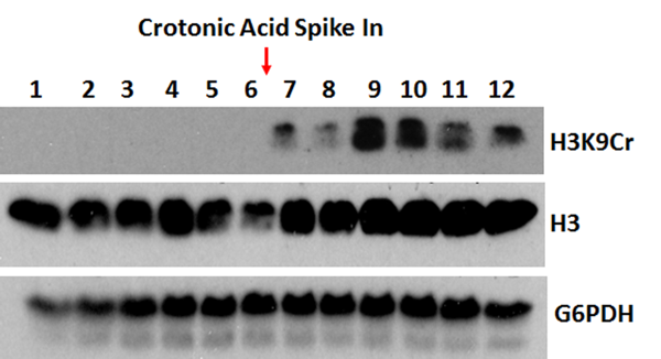 Anti-Crotonyl-Histone H3 (Lys9) Rabbit Monoclonal Antibody, Clone RM339