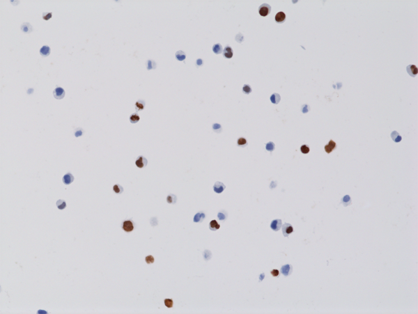 Anti-Histone H3 K4M Rabbit Monoclonal Antibody, Clone RM363