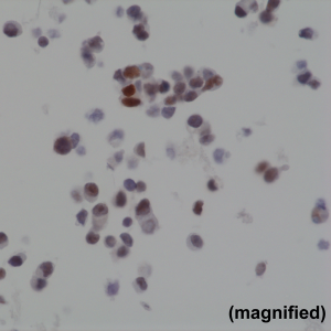 Immunohistochemical