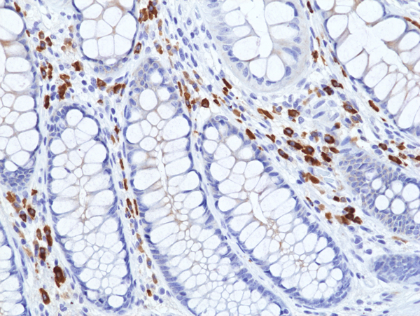 Anti-Human IgA (&alpha;1 & &alpha;2) Rabbit Monoclonal Antibody, Clone RM513