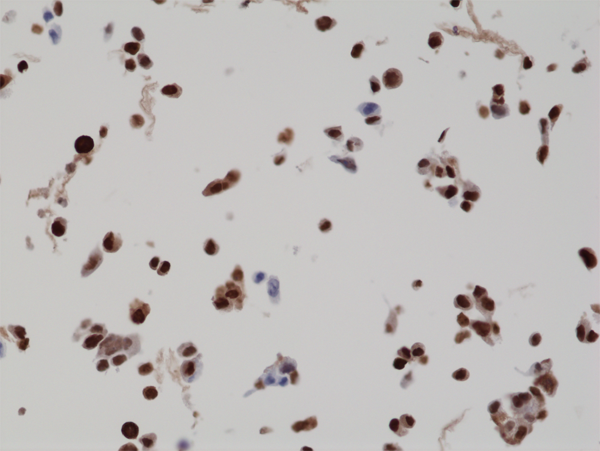 Anti-BAG-1L Rabbit Monoclonal Antibody, Clone RM310