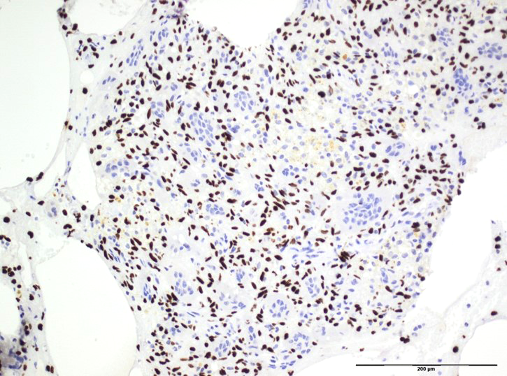 Anti-Histone H3.3 G34W Rabbit Monoclonal Antibody, Clone RM263