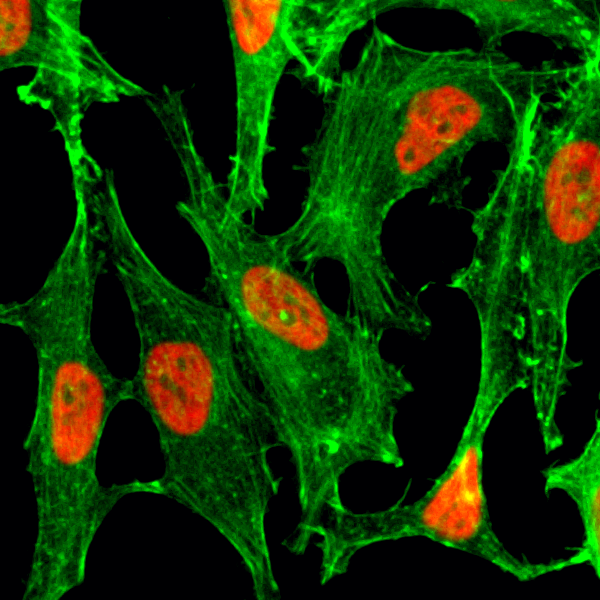 Anti-Acetyl-Histone H2B (Lys23) Rabbit Monoclonal Antibody, Clone RM260