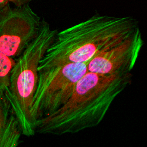 Anti-Acetylated-Lysine Rabbit Monoclonal Antibody, Clone RM101