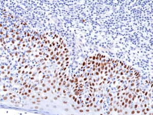 Immunohistochemical