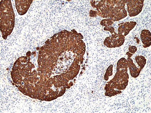 Anti-CK-14 (Cytokeratin-14) Rabbit Monoclonal Antibody, Clone RM328