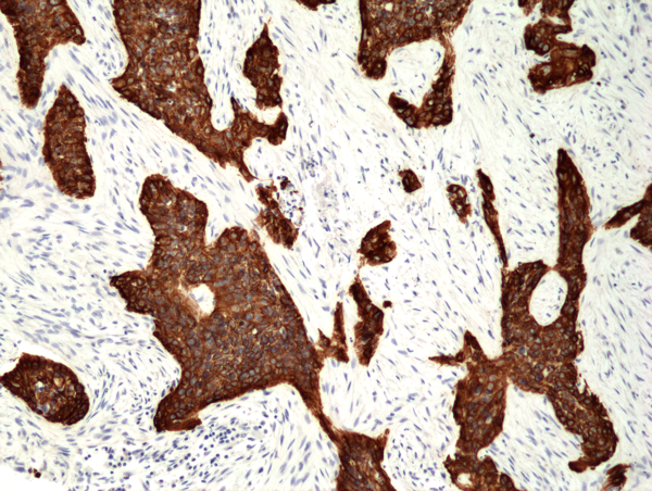 Anti-Cytokeratin 5 Rabbit Monoclonal Antibody, Clone RM226