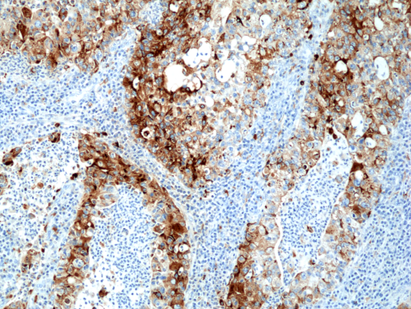 Anti-Napsin-A Rabbit Monoclonal Antibody, Clone RM366