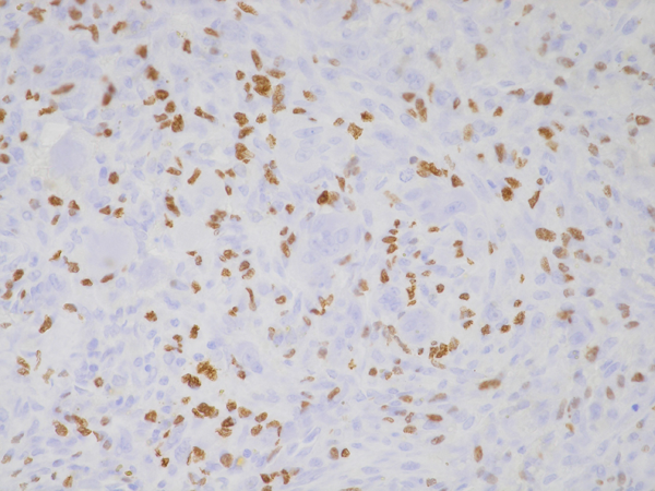 Anti-Histone H3.3 G34V Rabbit Monoclonal Antibody, Clone RM307
