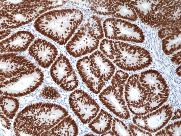 Anti-SATB2 Rabbit Monoclonal Antibody, Clone RM365