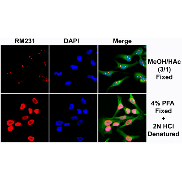 Anti-5-methylcytosine (5-mC) Rabbit Monoclonal Antibody, Clone RM231