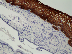 Immunohistochemical