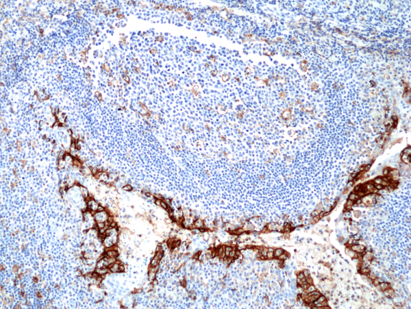 Anti-PD-L1 (CD274) (B7-H1) Rabbit Monoclonal Antibody, Clone RM320