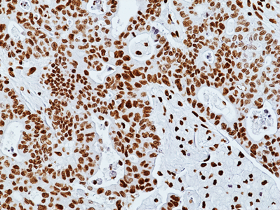 Anti-Acetyl-Histone H3 (Lys27) Rabbit Monoclonal Antibody, Clone RM172