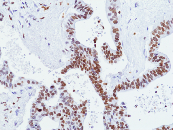 Anti-Trimethyl-Phospho-Histone H3 (Lys9/Ser10) Rabbit Monoclonal Antibody, Clone RM162