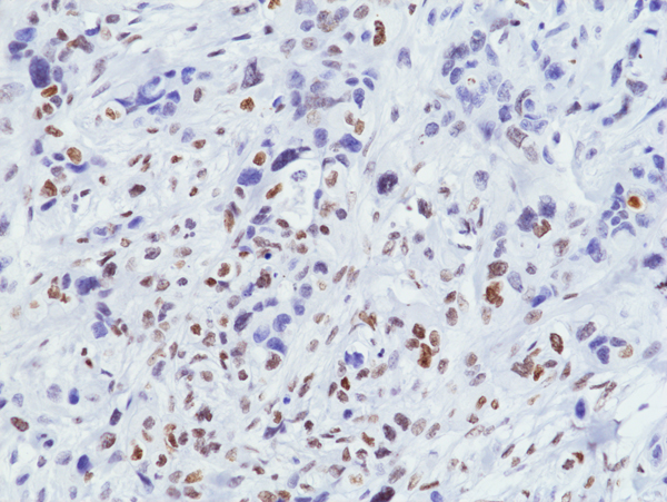Anti-Trimethyl-Phospho-Histone H3 (Lys9/Ser10) Rabbit Monoclonal Antibody, Clone RM162