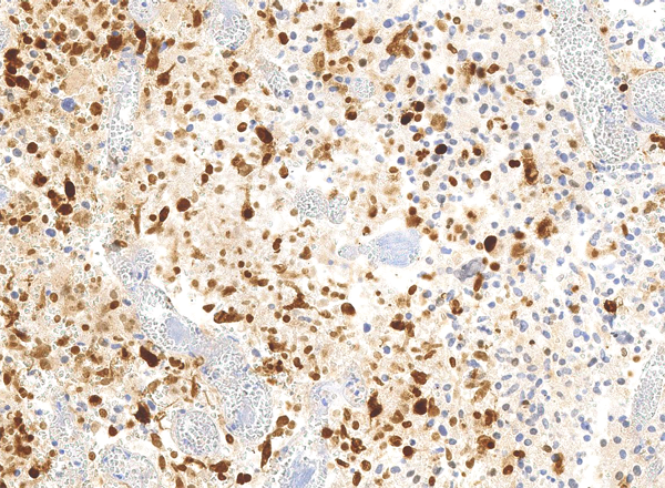 Anti-Histone H3.3 G34R Rabbit Monoclonal Antibody, Clone RM240