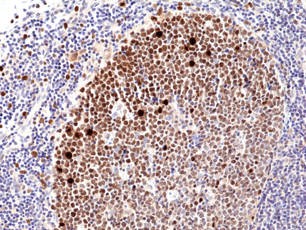 Anti-KI67 Rabbit Monoclonal Antibody, Clone RM360: NEW CLONE with Improved Performance!
