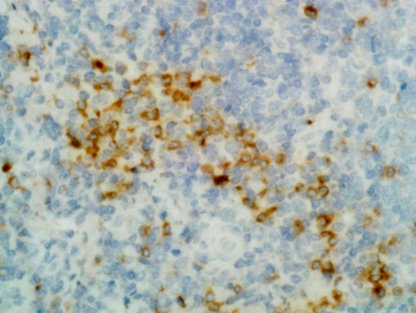 Anti-Human Gamma Heavy Chain Rabbit Monoclonal Antibody, Clone RM116