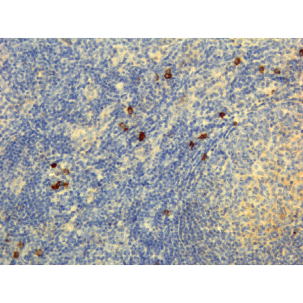 Anti-Human IgG4 Rabbit Monoclonal Antibody, Clone RM120