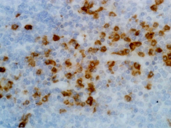 Anti-Human Kappa Light Chain Rabbit Monoclonal Antibody, Clone RM126