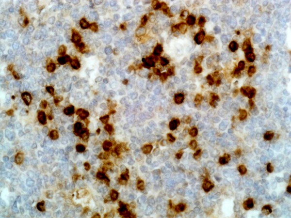 Anti-Human Lambda Light Chain Rabbit Monoclonal Antibody, Clone RM127