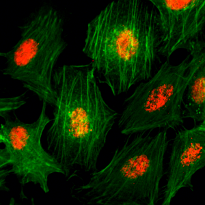 Immunocytochemistry