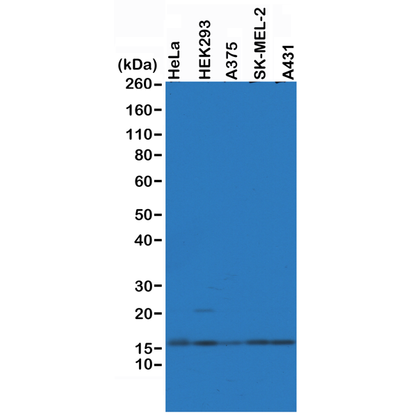 Anti-Histone H2AZ Rabbit Monoclonal Antibody, Clone RM215