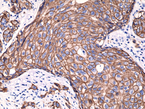 Anti-HER2 (c-erbB-2) Rabbit Monoclonal Antibody, Clone RM228