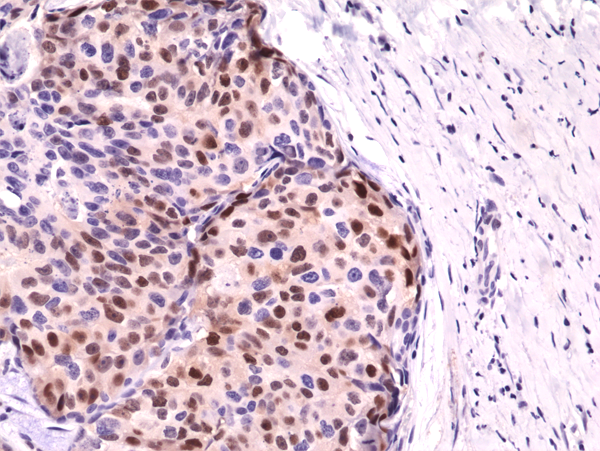 Anti-Cyclin D1 (CCND1) Rabbit Monoclonal Antibody, Clone RM241