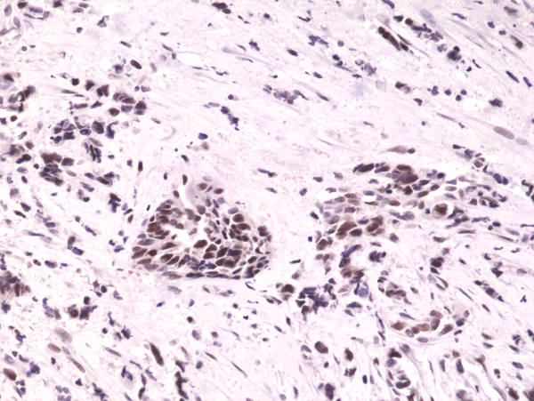 Anti-HIF-1-alpha Rabbit Monoclonal Antibody, Clone RM242